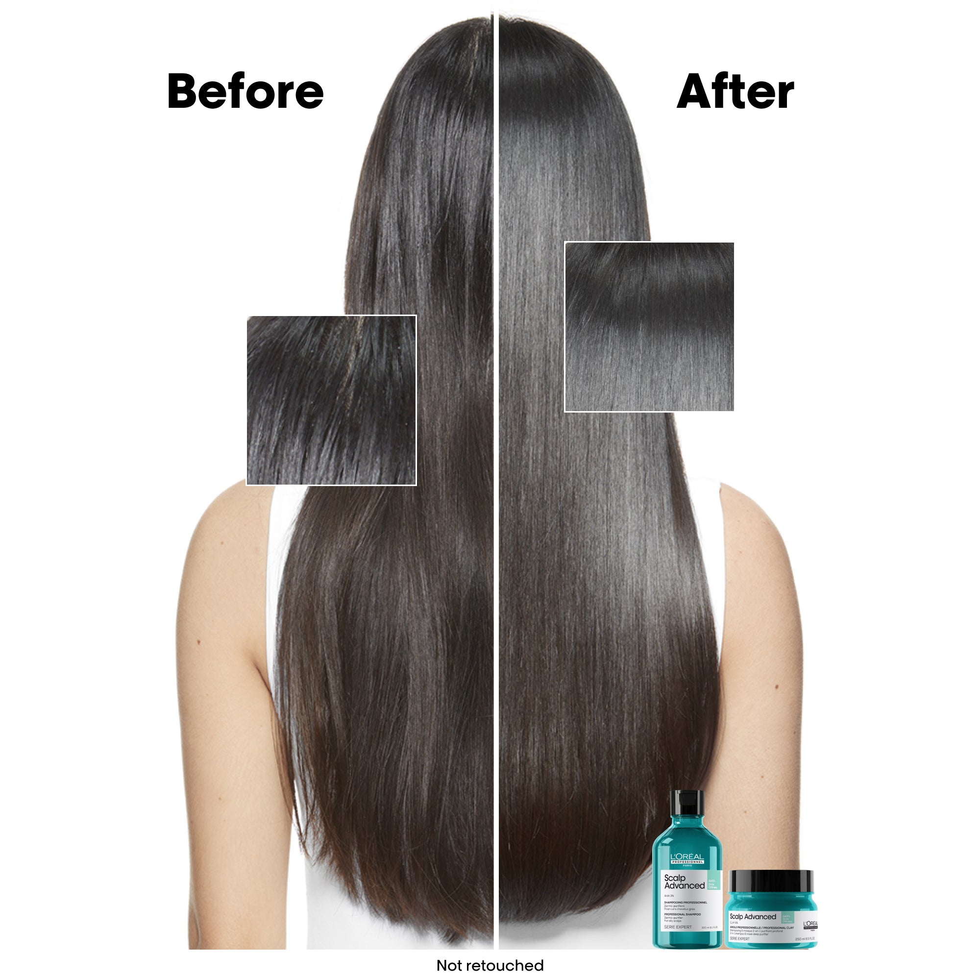 3474637090531_3_ff1a3fd9-5c1f-4836-abef-57643d7749c2.jpg L'Oreal Professionnel Serie Expert Scalp Advanced Anti-Oiliness 2-in-1 Deep Purifier Clay Shampoo & Mask 250ml - Image 1