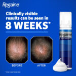 Regaine For Men 5% Extra Strength Regrowth Foam 3 Month Supply - Image 5
