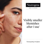 Neutrogena Clear & Defend+ Ultra-Thin Hydrocolloid Blemish Patches x24 - Image 5