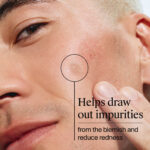 Neutrogena Clear & Defend+ Ultra-Thin Hydrocolloid Blemish Patches x24 - Image 9