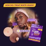 Acnecide + Purifide Power Patch Skin Restore Hydrocolloid Pimple Patches x23 - Image 7