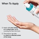 Anua BHA 2% Gentle Exfoliating Toner 150ml - Image 3