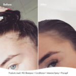 BondiBoost Anti-Thinning Intensive Scalp Spray 125ml - Image 2