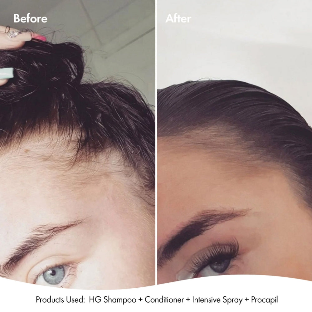 BOND0016-4.jpg BondiBoost Procapil Scalp Tonic 125ml - Image 1