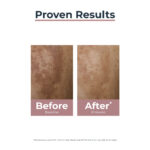 Eucerin Anti-Pigment Day Cream SPF30 50ml - Image 5