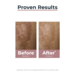 Eucerin Anti-Pigment Skin Perfecting Serum 30ml - Image 7
