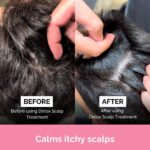 FUL Detox Scalp Treatment 150ml - Image 3
