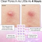 Grace & Stella Hydrocolloid Pimple Patches Heart x36 - Image 6