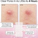 Grace & Stella Hydrocolloid Pimple Patches Clear x72 - Image 3