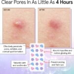 Grace & Stella Hydrocolloid Pimple Patches Multishape x72 - Image 8