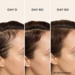 John Frieda PROfiller+ Hair Growth Scalp Serum 50ml - Image 4