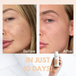 Kanzen Derma Pore Purifier 125ml - Image 4