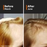 Minimalist Hair Density Hair Serum 18% 30ml - Image 8