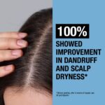 Neutrogena T-Gel Anti-Dandruff Scalp Relief Shampoo 250ml - Image 4