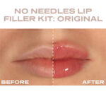 Plump It No Needles Lip Filler Kit - Image 2