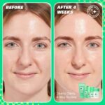 Revolution Skincare Pore Player Clarifying BHA Toner 150ml - Image 4