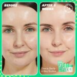 Revolution Skincare Clearly Clarify 4 Step Clarifying Routine - Image 5