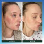 Sorted Skin Intensive Rescue Face Lotion 50ml - Image 3