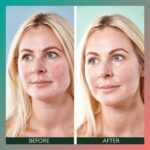 Sorted Skin 5-In-1 Anti-Redness Day Cream SPF50 30ml - Image 2