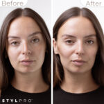 StylPro Mini Microcurrent Facial Toning Device - Image 7