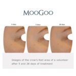 MooGoo Bakuchiol 1% Natural Retinol Substitute Active Serum 25ml - Image 4