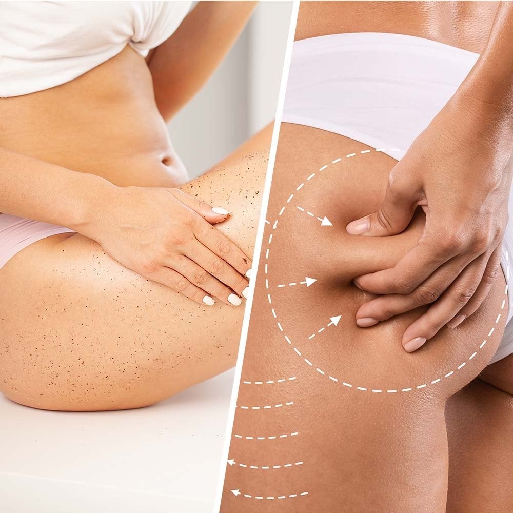 biovene-niacin-cellulite-extra-firming-organic-coconut-sugar-talasso-body-exfoliator-250ml-p30133-78495_image.jpg Biovene Niacin Cellulite Extra-Firming Body Exfoliator 250ml - Image 1