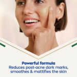 Nivea Cellular Luminous 630 Anti Dark-Spot Post-Acne Dark Marks Serum 30ml - Image 4