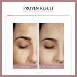 Eucerin Anti-Pigment Dual Face Serum 30ml - Image 7