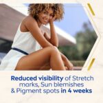 Nivea Luminous 630 Anti-Stretch Marks & Dark Spots Body Cream 200ml - Image 3