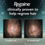 Regaine For Men 5% Extra Strength Regrowth Foam 1 Month Supply - Image 8