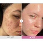 CosRx The Niacinamide 15 Serum 20g - Image 4